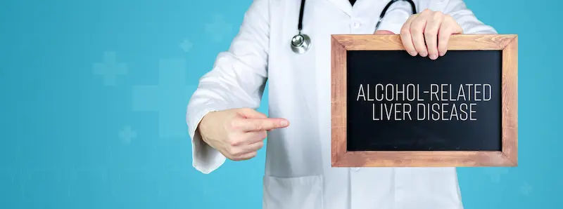 Alcohol related Liver Disease